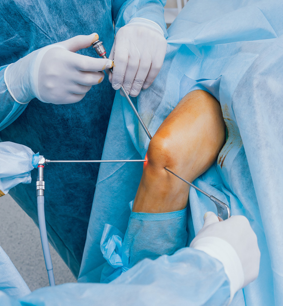 Knee Arthroscopy