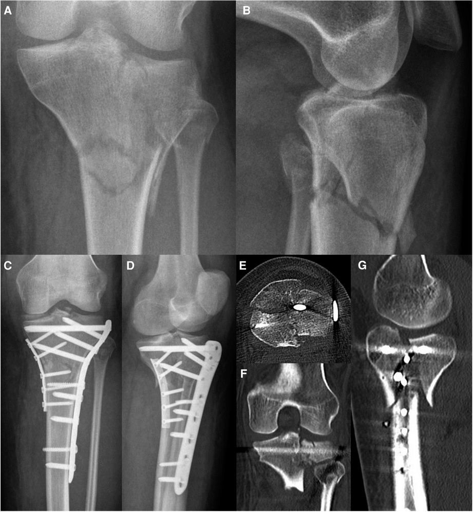 Minimally Invasive Trauma